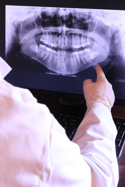 Best Knocked-Out Tooth Emergency  in Cleveland, AL